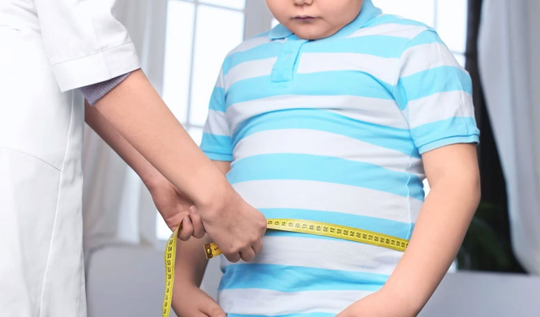 Obesity in Children